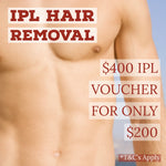 IPL Painless Hair Removal - $400 Voucher for only $200